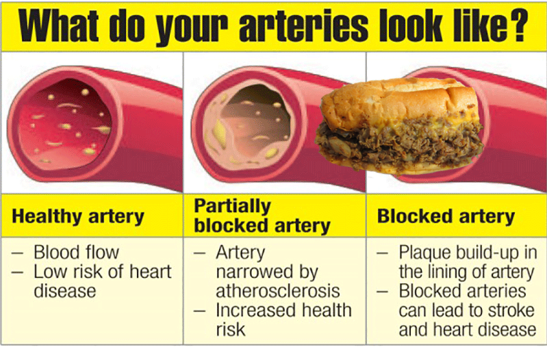 arteries.png